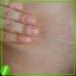 Effective Tips to Prevent Stretch Marks